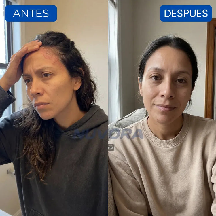 CASOS DE ÉXITO