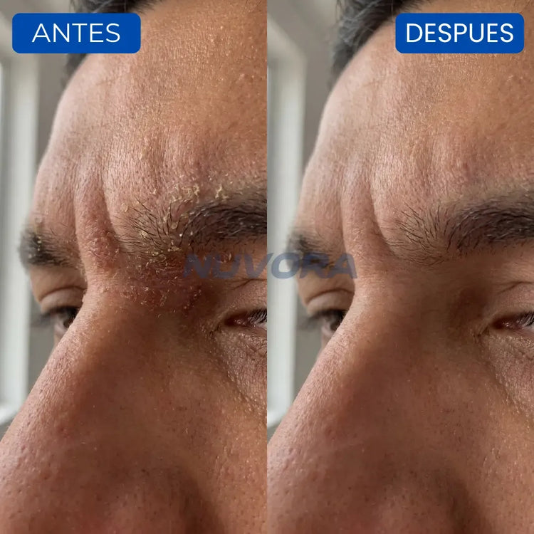 CASOS DE ÉXITO