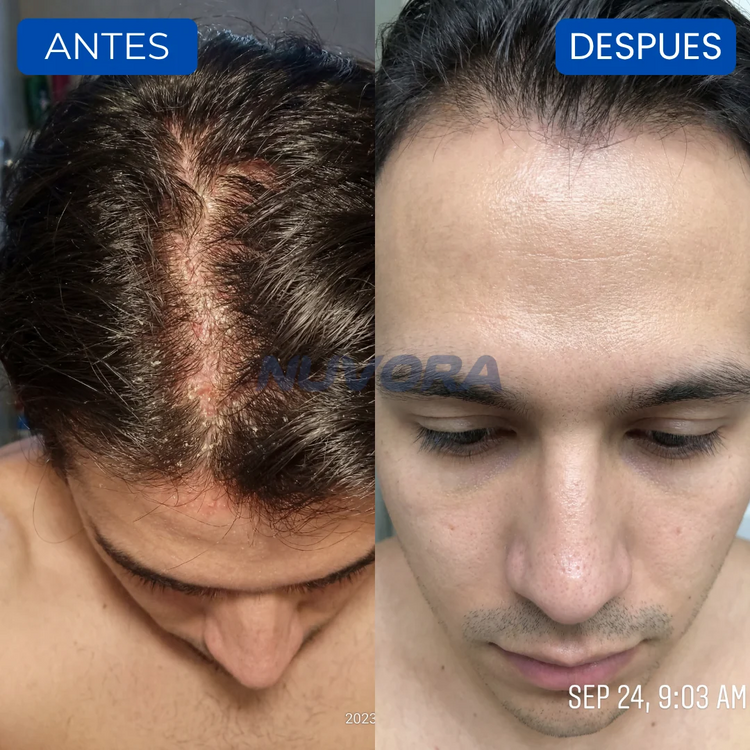 CASOS DE ÉXITO